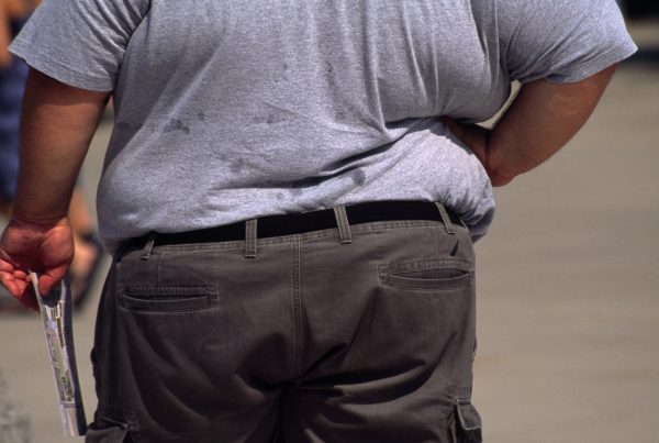 Zo is het om morbide obesitas te hebben in de Verenigde Staten
