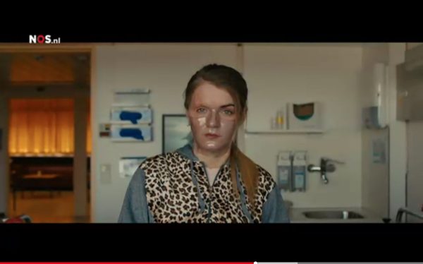 Heftige film over zuuraanval wordt gedragen door actrice met brandwonden: 'Mensen associëren me met een monster'