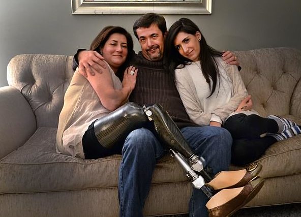 leven na aanslag Boston met prothese
