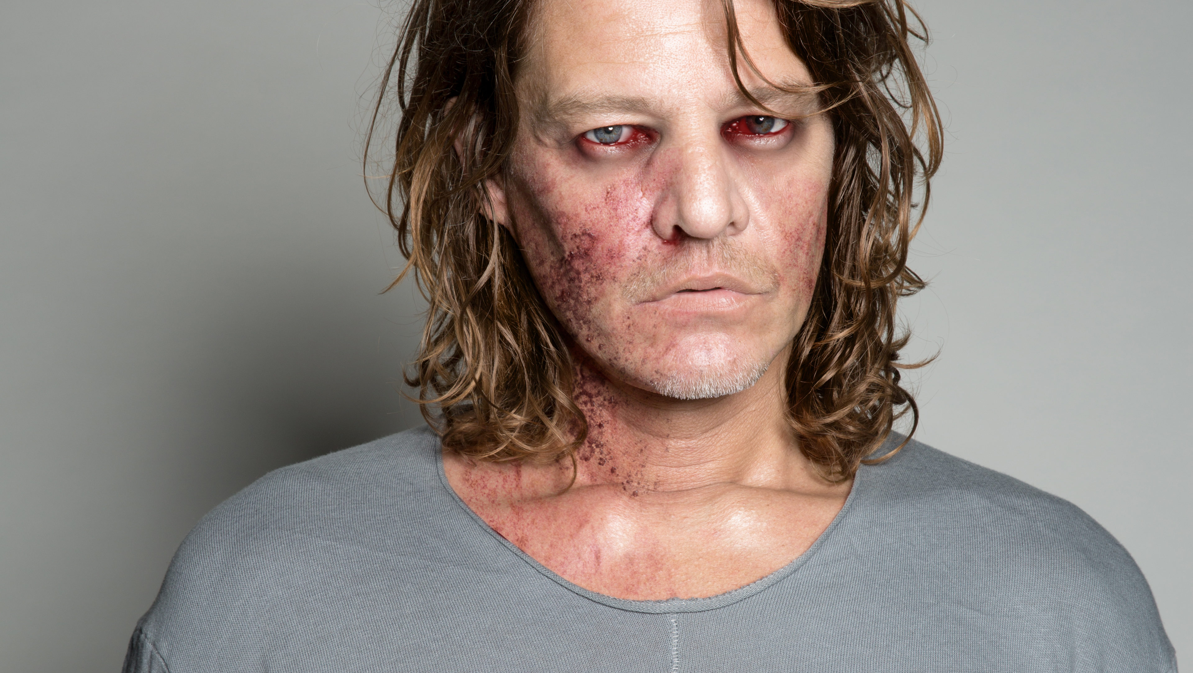 Instagramfeed Tygo gernandt ebola artsen zonder grenzen