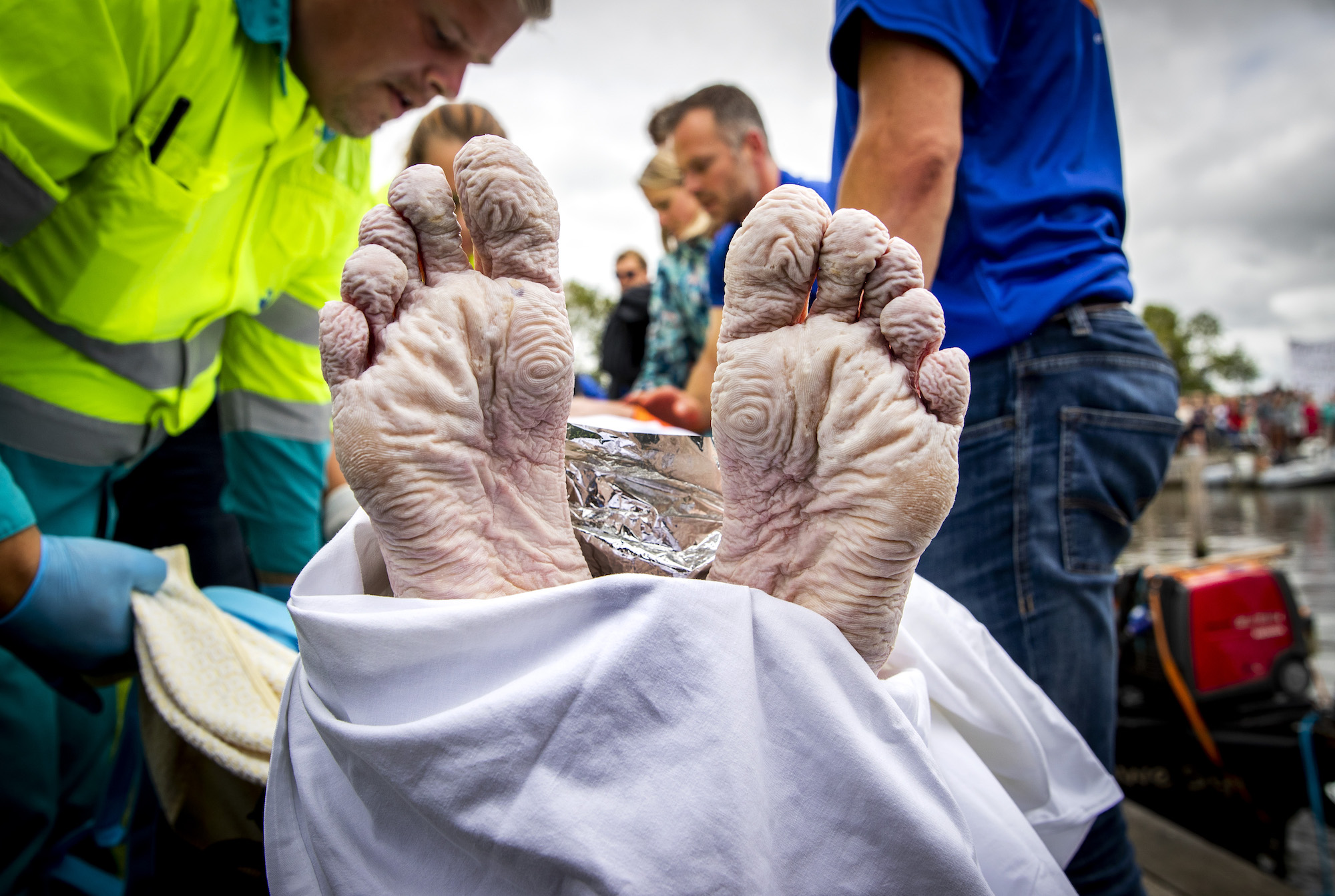 Voeten van Maarten na 55 uur zwemmen