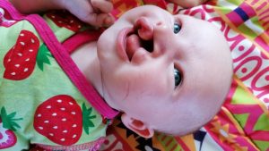 Thumbnail voor Anne kreeg een baby met een schisis: 'Ze vroegen of ik een abortus wilde'