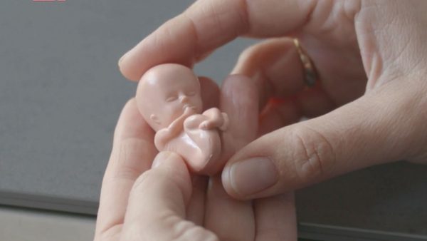 abortus pro-life pro-choice
