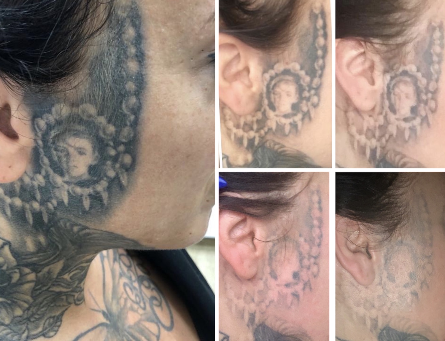 Ongebruikt Pcilla (34) heeft spijt van tattoo in gezicht: 'Mensen hebben DD-22