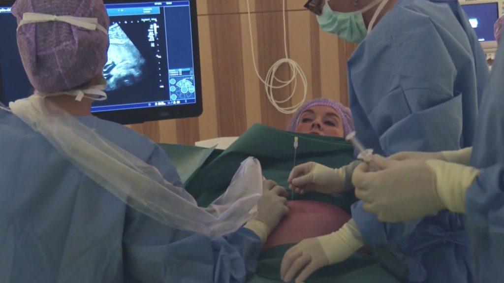 baby bloedtransfusie topdokters