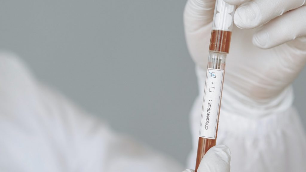 Coronavirus was al veel eerder in Nederland