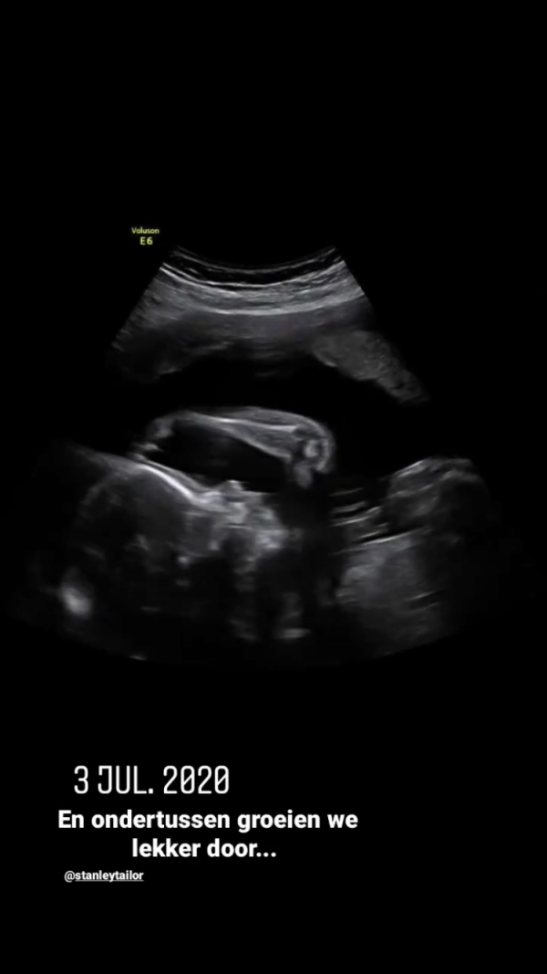 ZWANGERE KIM FEENSTRA TRAKTEERT VOLGERS OP ECHOBEELDEN