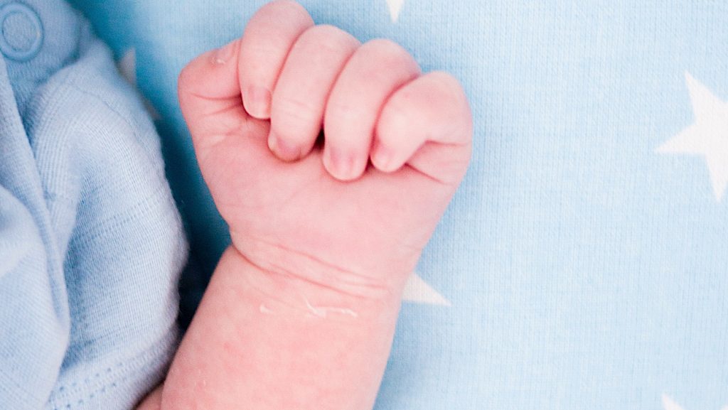 Baby arm breken tijdens bevalling
