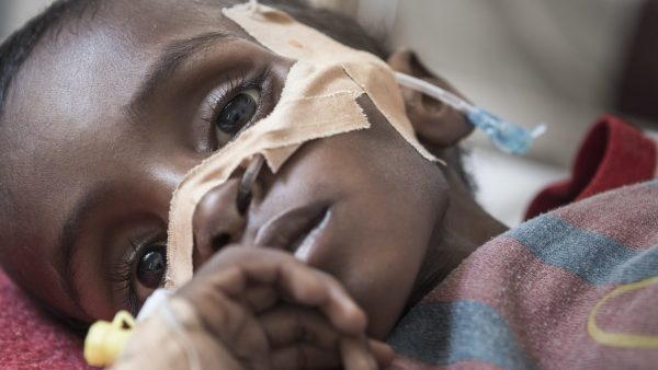 Ruim 6 miljoen kinderen dreigen ondervoed te raken door coronacrisis