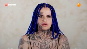 Thumbnail voor Leven met een extreem uiterlijk: 'Mijn kinderen worden niet meer uitgenodigd voor feestjes'