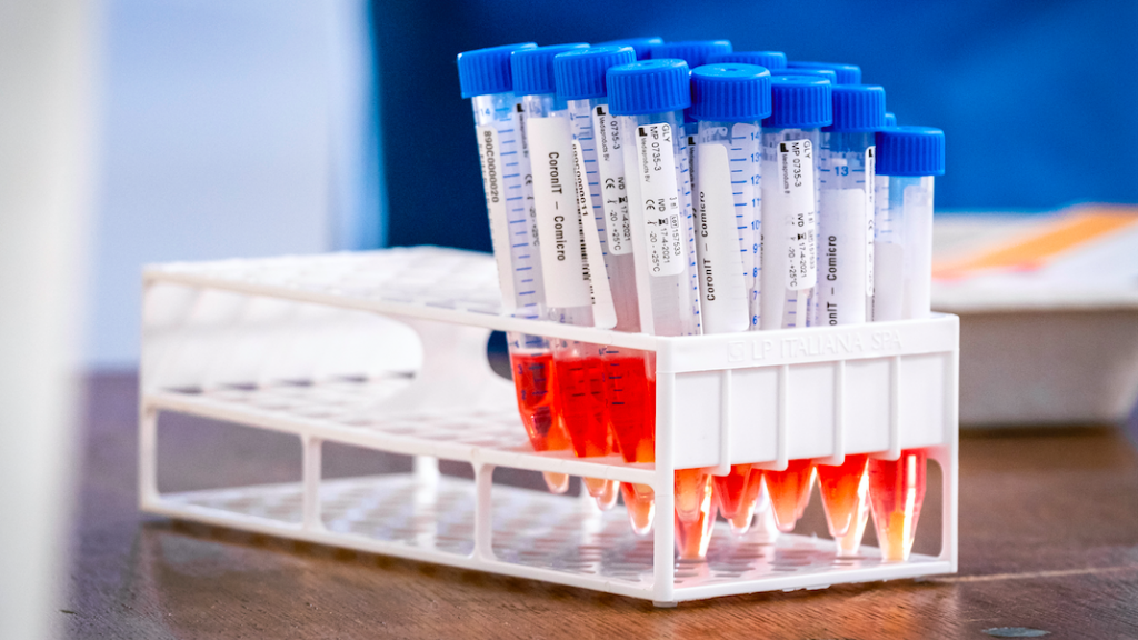 GGD Kennemerland geeft 35 mensen verkeerde uitslag coronatest