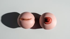 Thumbnail voor Plat versus pront: vrouwen delen ervaringen met borstreconstructie na kanker