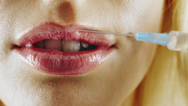 Kleine kans op bijwerkingen Moderna-vaccin als je fillers hebt