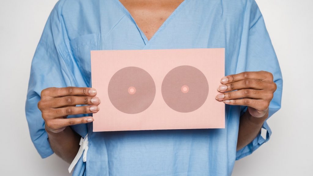 mri-scan vrouwen dicht borstweefsel