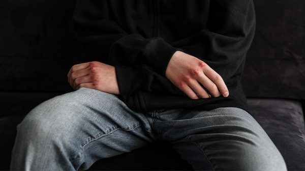 Topman OM heeft zorgen om explosieve stijging excessief geweld onder jongeren