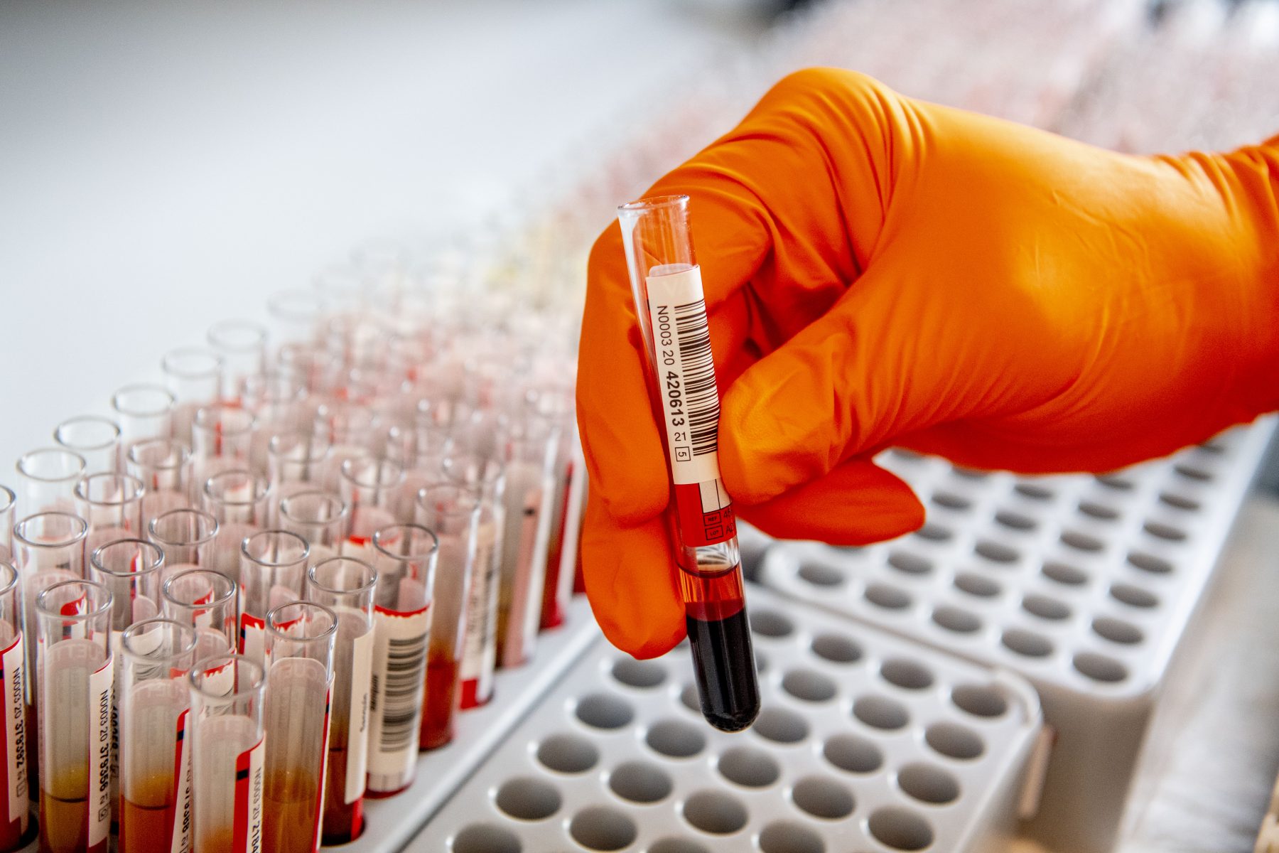 Meer dan de helft van de Nederlanders heeft nu antistoffen tegen corona