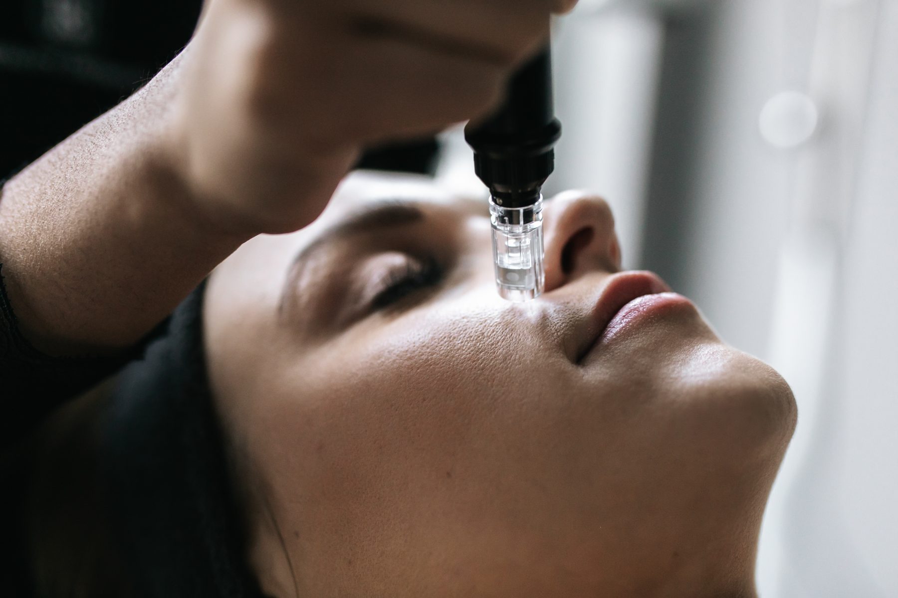 Zorgen bij huidtherapeuten: 'Vrouwen thuis zelf aan de slag met dermapen'