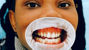Thumbnail voor 'Silent disease' parodontitis: 'Uiteindelijk kun je je tanden verliezen'