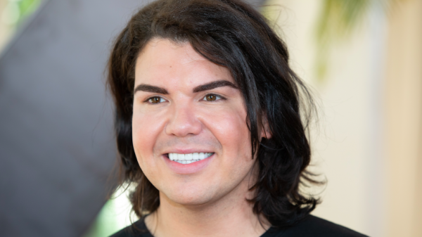 Roy Donders reageert op kritiek baardtransplantatie