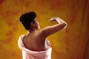 Vrouwenrechtenorganisatie wil vergoeding verwijdering borstimplantaten