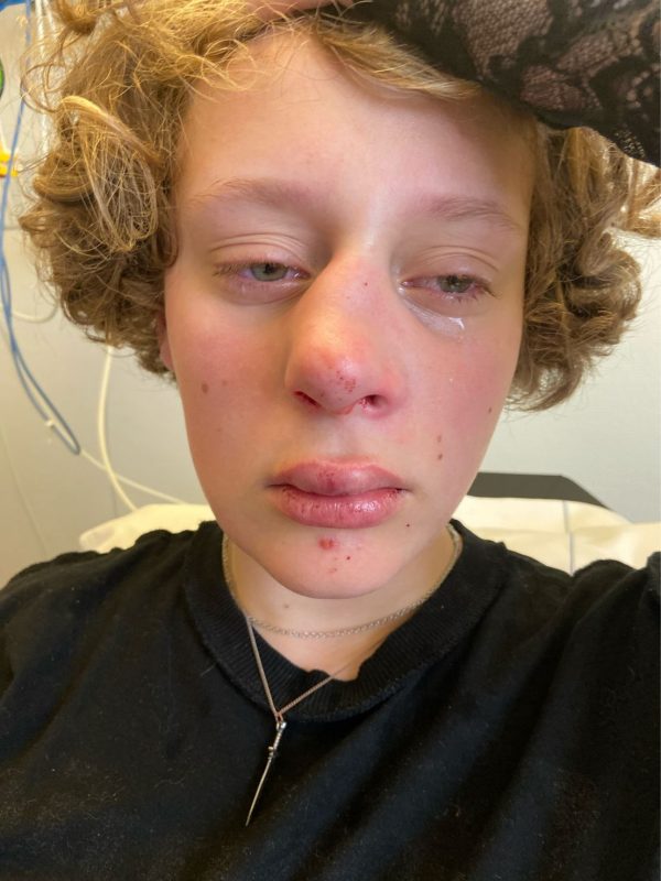 Frédérique (14) ziekenhuis in geslagen nadat ze niet wil zeggen of ze jongen of meisje is