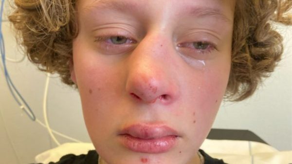 Verdachte mishandeling Frédérique op vrije voeten