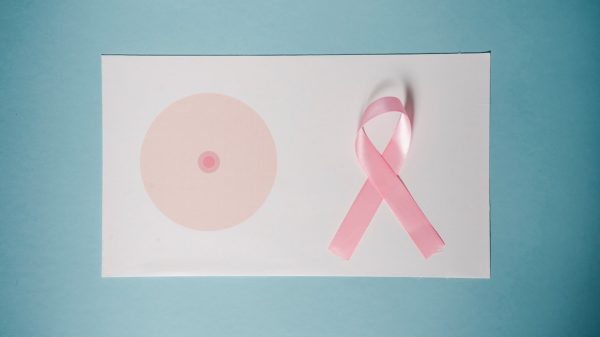 Invoering nieuwe technieken voor controle borstkanker duurt jaren