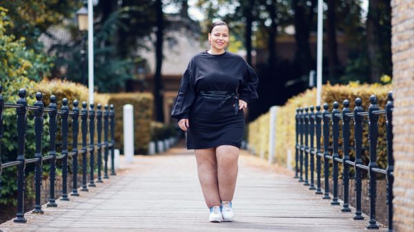 Joyce, 4 maanden na haar liposucties tegen lipoedeem: 'Een helse reis, maar het helpt'