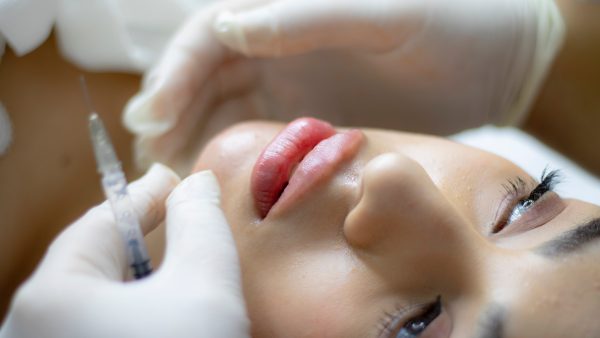 Engeland verbiedt botox en fillers voor minderjarigen als actie tegen 'Instagramgezicht'