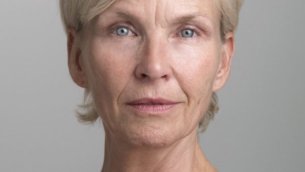 Anita Witzier: 'Babybotox is leuk, hoor. En je knapt er echt van op'