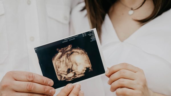 Wil je zien: voor het eerst haarscherp beeld van een embryo van zes weken oud