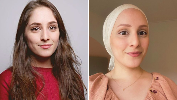 Shila heeft Alopecia Universalis: 'Het verliezen van je haar is een rouwproces'
