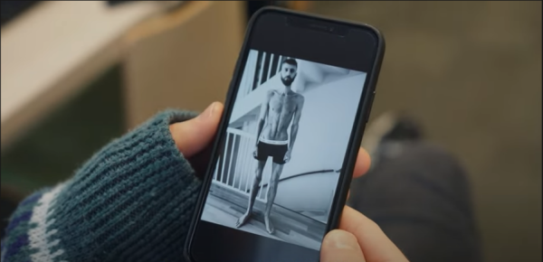 Gosse volgt vriend Tom in herstel anorexia