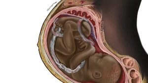 Student die zwarte foetus illustreerde publiceert afbeeldingen in medisch boek