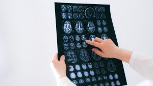 Thumbnail voor Patiënt met compleet 'locked-in-syndroom' communiceert via hersenactiviteit