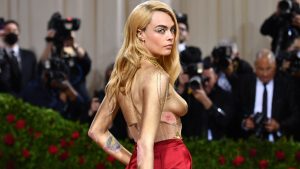 Thumbnail voor Cara Delevingne weigerde haar psoriasis te verbergen op de rode loper van MET-Gala