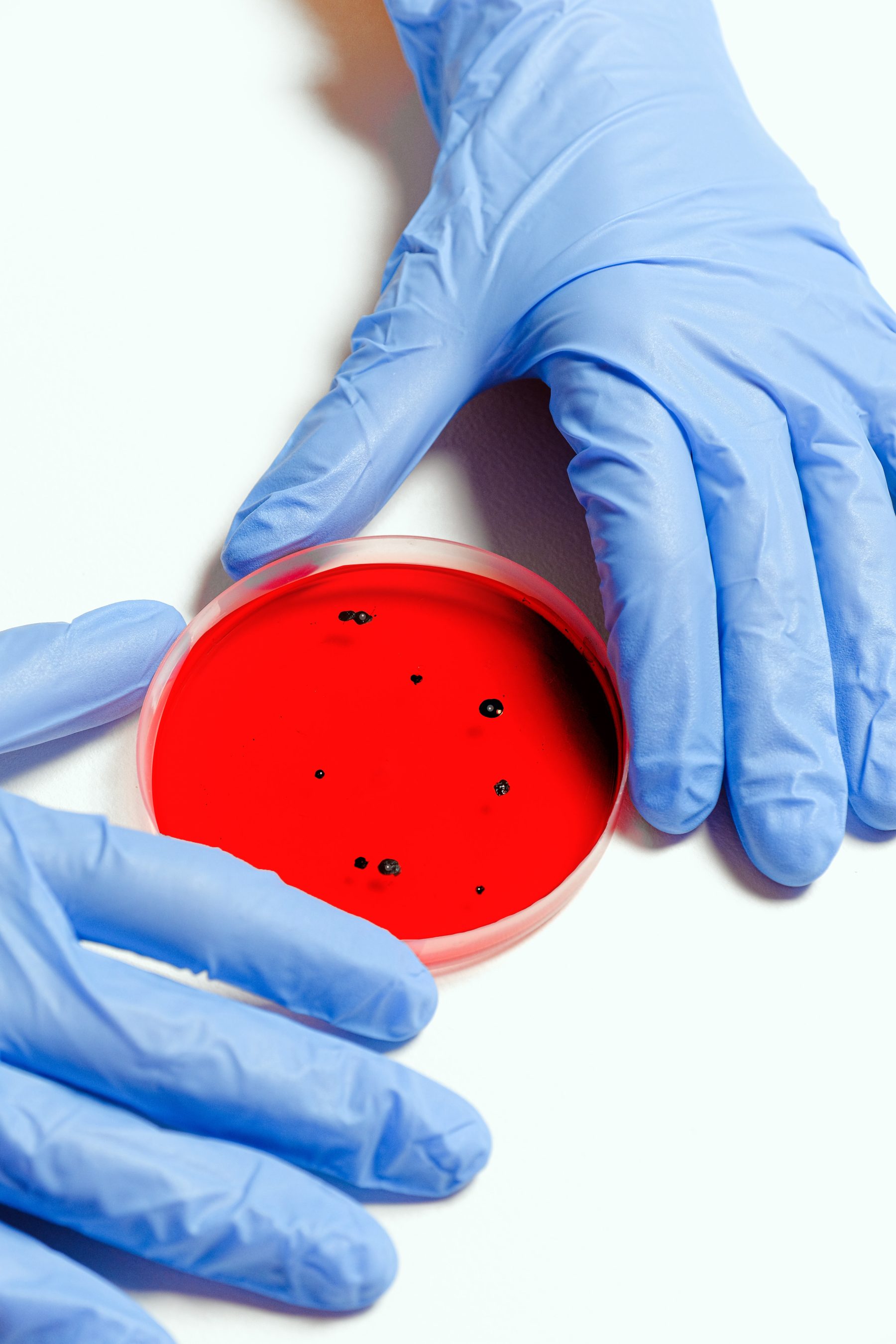 toename-overlijden-jonge-mensen-combinatie-virus-en-bacterie
