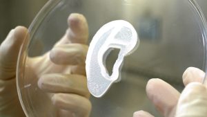 Thumbnail voor Mexicaanse vrouw krijgt nieuw oor van eigen celmateriaal gemaakt door 3D-printer