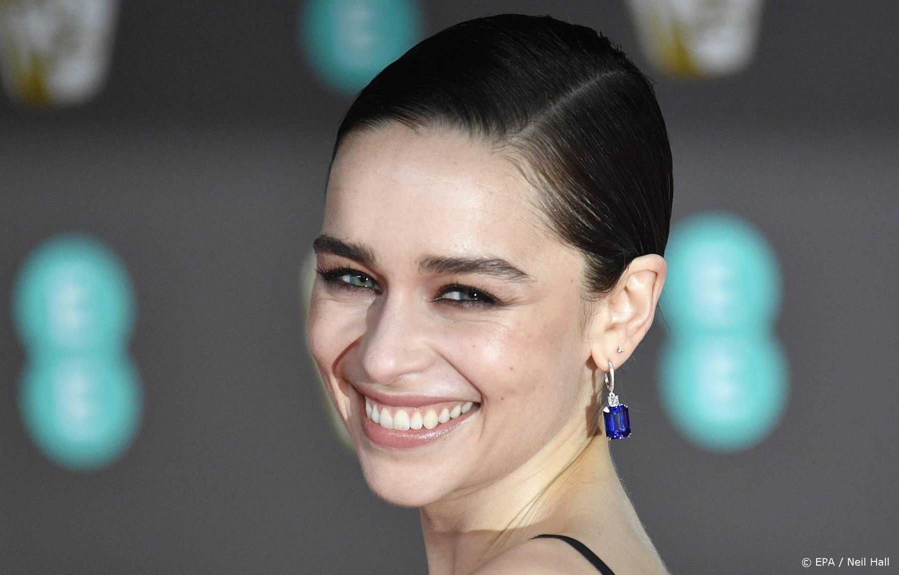 Actrice Emilia Clarke mist deel van hersenen door aneurysma’s