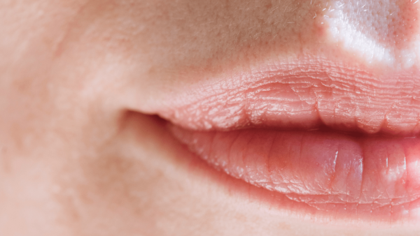 fillers