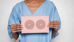 Thumbnail voor Van vijftien naar vijf bestralingen voor vrouwen met borstkanker