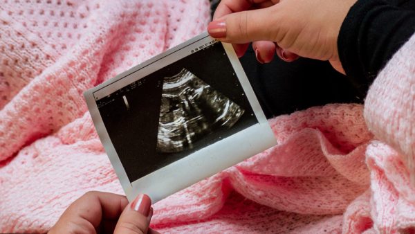 De gezondheid van je kind begint al vóór de zwangerschap