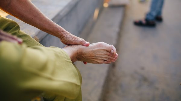 Blaren voorkomen en genezen: dit moet je erover weten