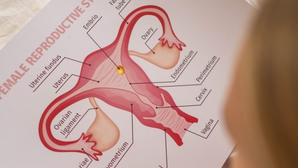 Alles over vleesbomen in de baarmoeder: 5 vragen aan een gynaecoloog