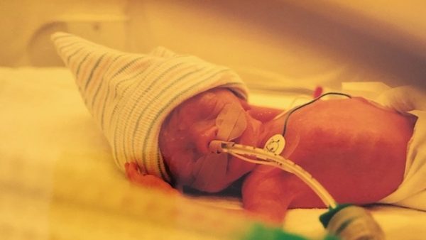 Wereld Prematurendag: Marit werd met 27 weken en 680 gram geboren: 'Artsen geloofden er niet in'