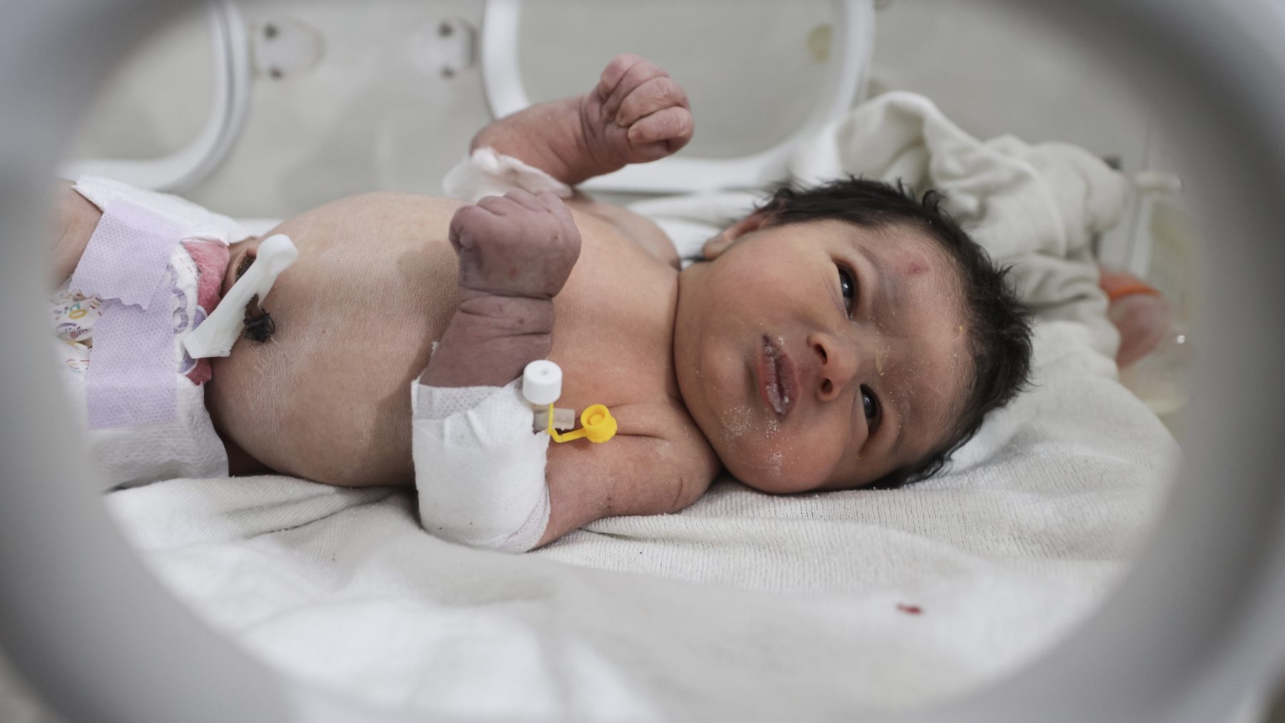 Duizenden willen geredde baby adopteren