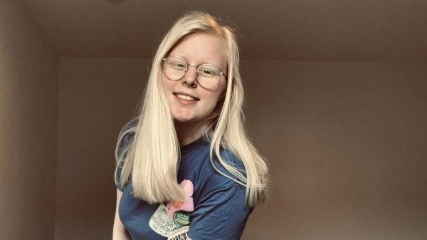 Luna (19) heeft albinisme: 'Mensen noemen me geen 'echte' albino'