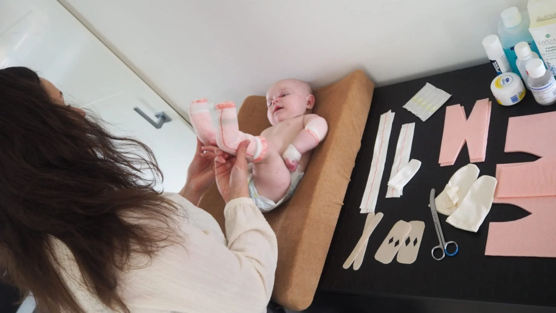 Dax (0) is een vlinderkind: 'Na de bevalling zagen we dat zijn hoofdhuid ontbrak'