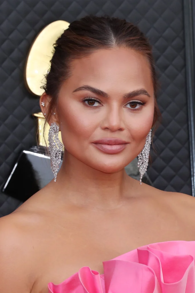 chrissy teigen buccal fat removal