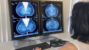 Thumbnail voor Echo kan bij borstkankeronderzoek net zo betrouwbaar zijn als mammografie